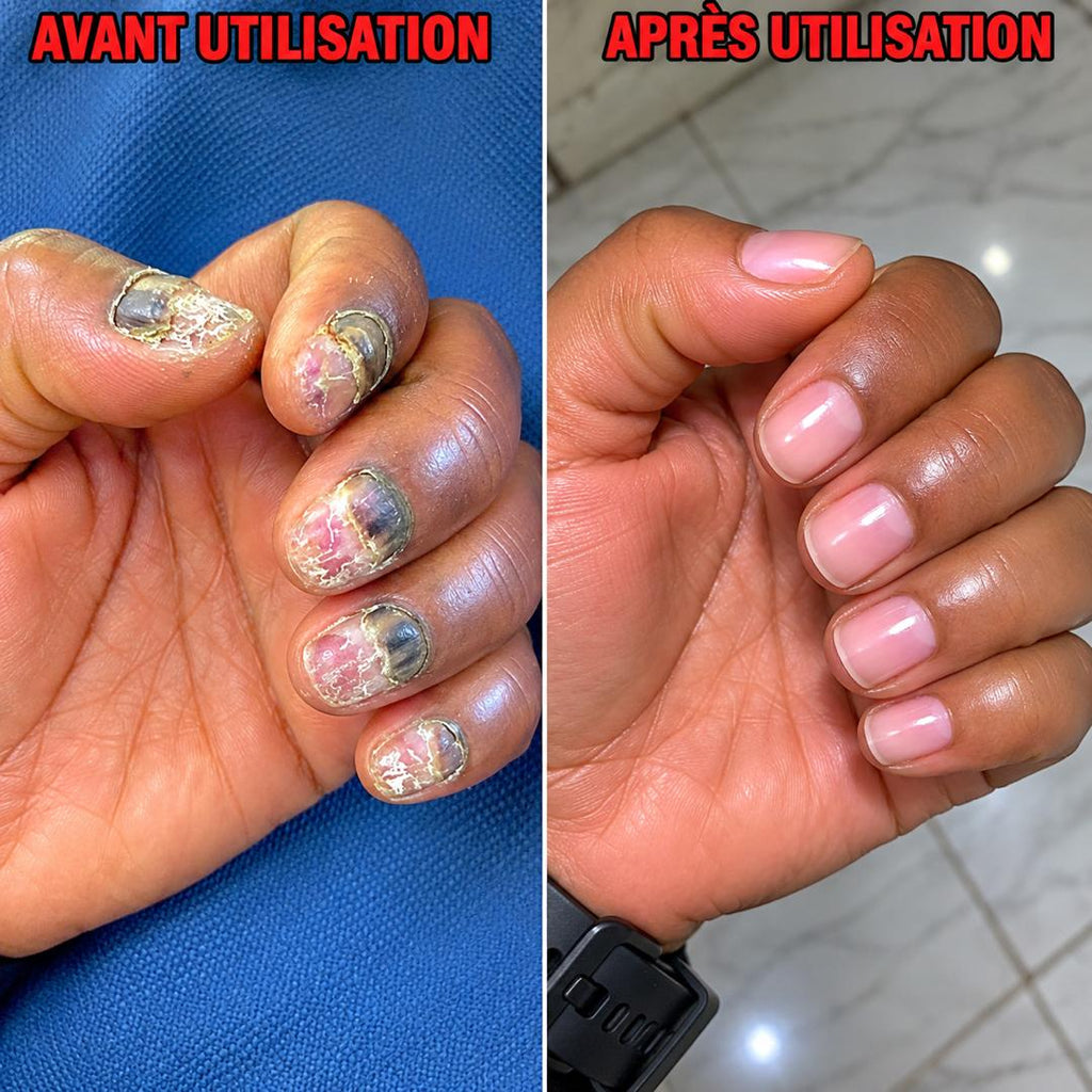 𝐑𝐞𝐭𝐫𝐨𝐮𝐯𝐞𝐳 𝐥𝐚 𝐟𝐢𝐞𝐫𝐭𝐞́ 𝐝𝐞 𝐦𝐨𝐧𝐭𝐫𝐞𝐫 𝐯𝐨𝐬 𝐦𝐚𝐢𝐧𝐬 𝐞𝐭 𝐯𝐨𝐬 𝐩𝐢𝐞𝐝𝐬 : 𝐄́𝐥𝐢𝐦𝐢𝐧𝐞𝐳 𝐥𝐞𝐬 𝐜𝐨𝐦𝐩𝐥𝐞𝐱𝐞𝐬 𝐞𝐭 𝐫𝐞𝐭𝐫𝐨𝐮𝐯𝐞𝐳 𝐝𝐞𝐬 𝐨𝐧𝐠𝐥𝐞𝐬 𝐜𝐥𝐚𝐢𝐫𝐬, 𝐬𝐚𝐢𝐧𝐬 𝐞𝐭 𝐬𝐚𝐧𝐬 𝐨𝐝𝐞𝐮𝐫 𝐝𝐞̀𝐬 𝐚𝐮𝐣𝐨𝐮𝐫𝐝'𝐡𝐮𝐢 !
